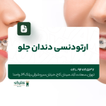 ارتودنسی دندان جلو