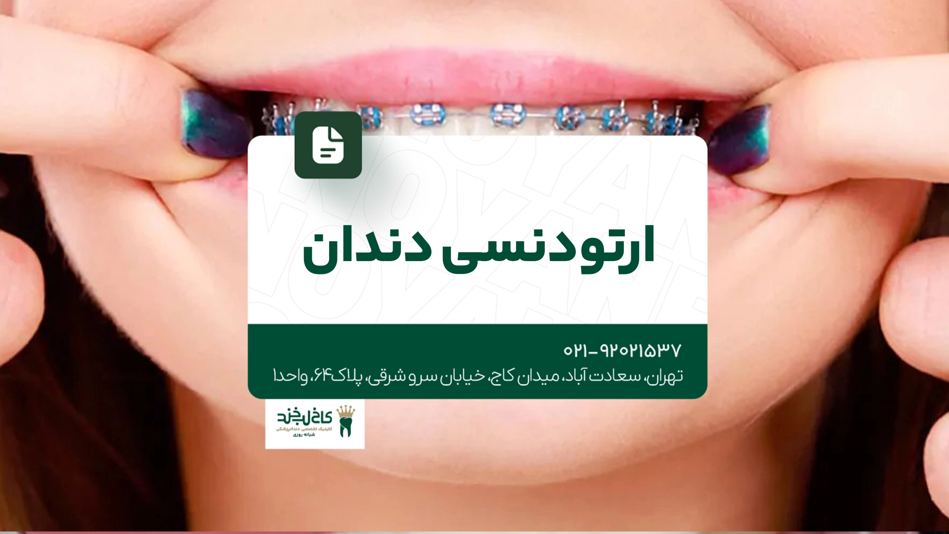 ارتودنسی دندان