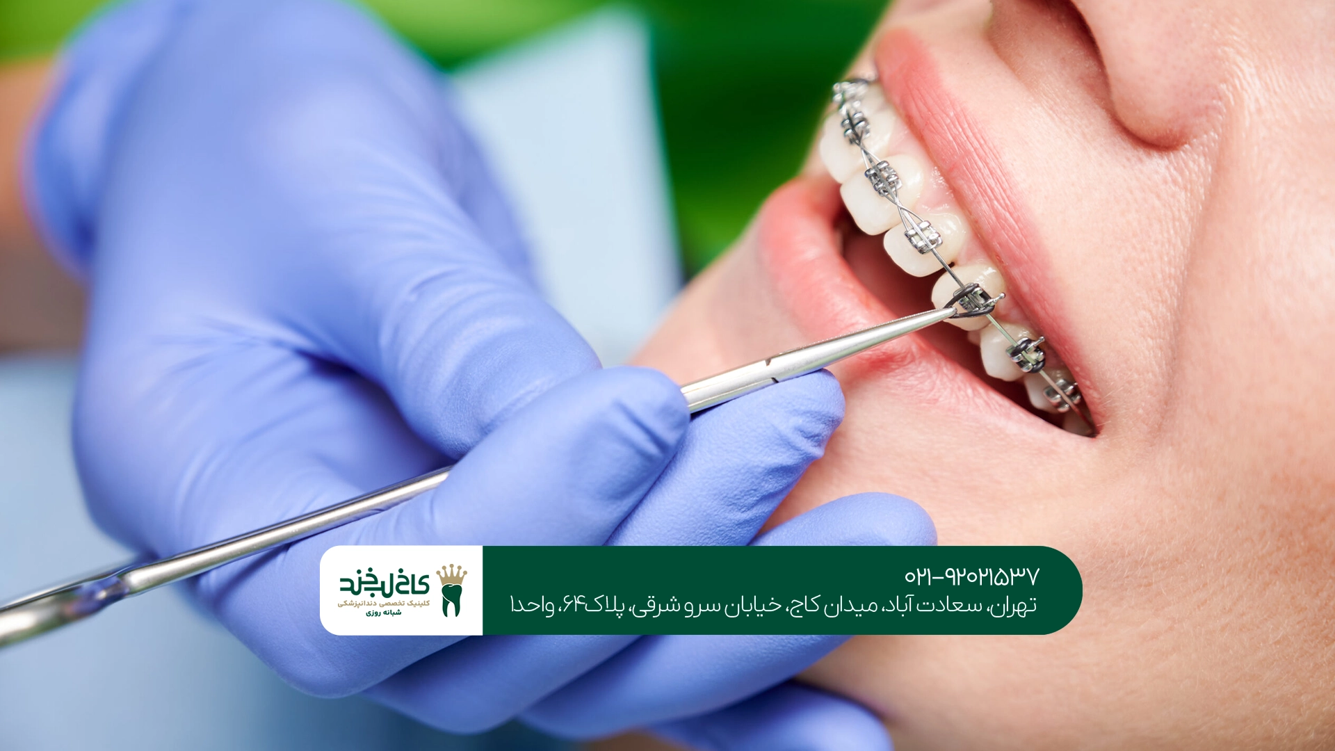 ارتودنسی سریع یا معمولی؟