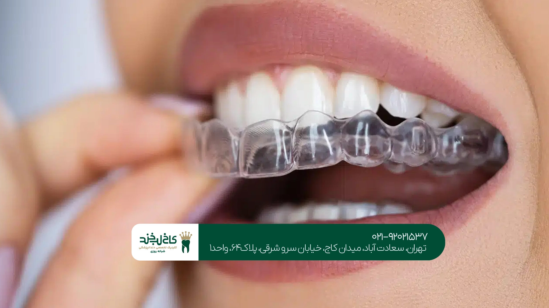 بهترین کلینیک ارتودنسی در تهران بهترین کلینیک ارتودنسی در تهران