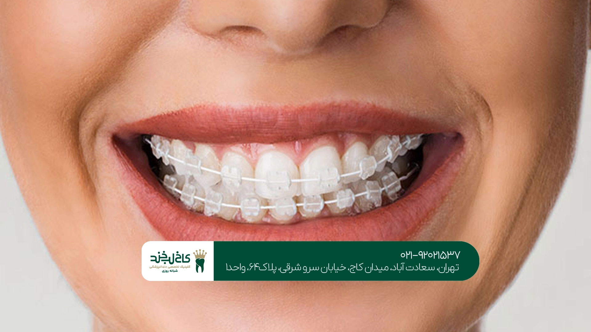 بهترین کلینیک ارتودنسی تهران بهترین کلینیک ارتودنسی تهران