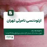ارتودنسی نامرئی تهران