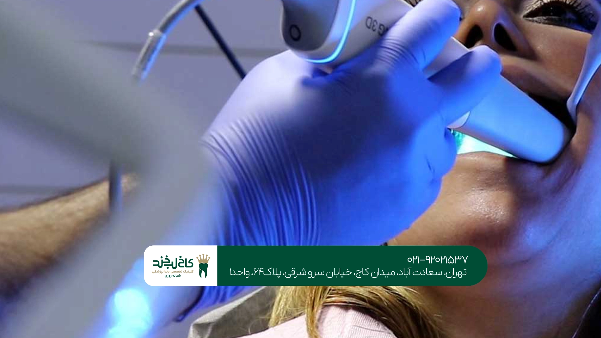 قیمت اسکن دیجیتال دندان