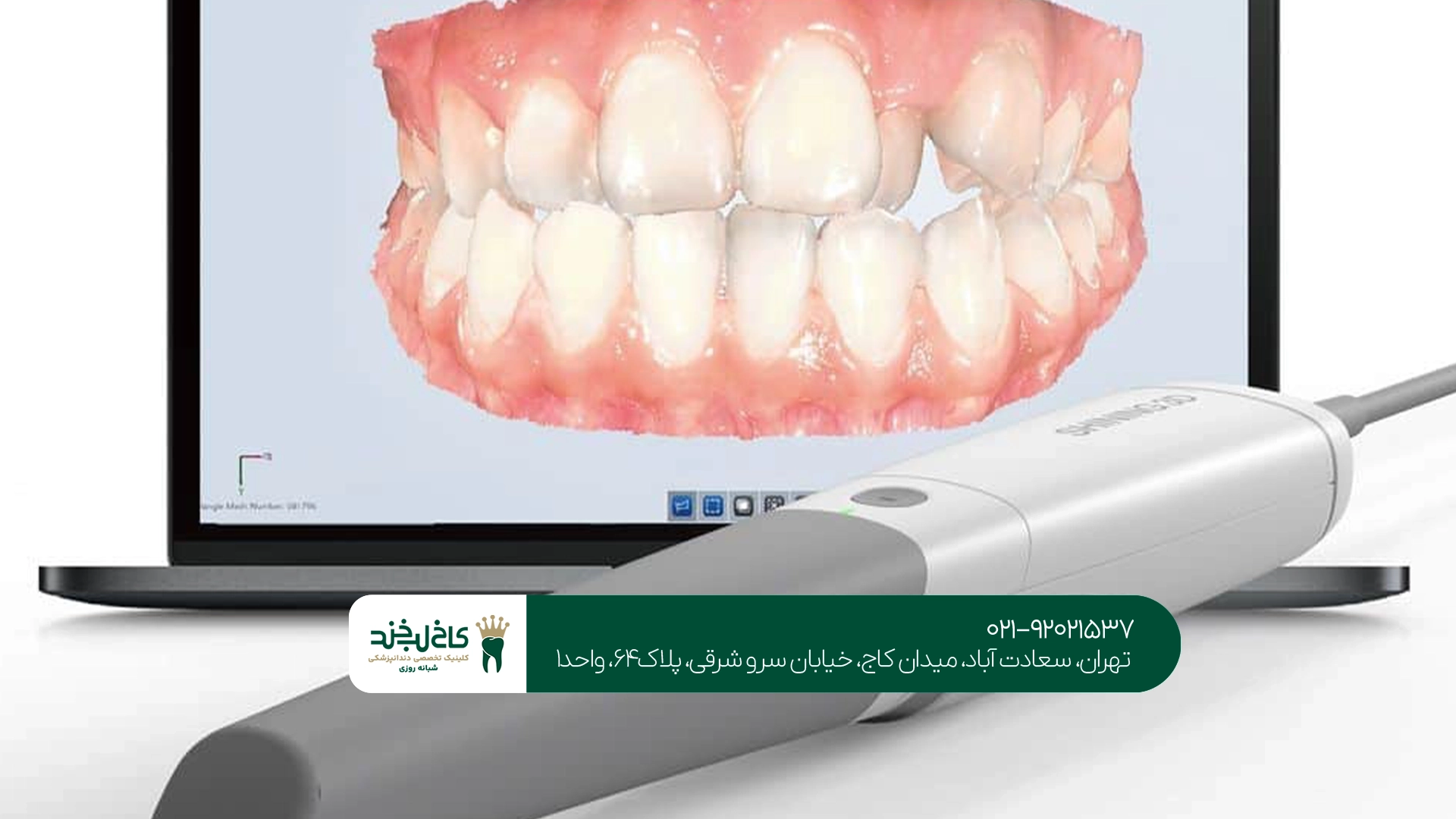 اسکن سه بعدی دندان برای چه درمانهایی استفاده میشود؟