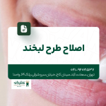اصلاح طرح لبخند