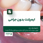 ایمپلنت بدون جراحی