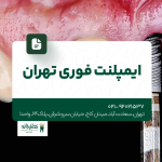 ایمپلنت فوری تهران