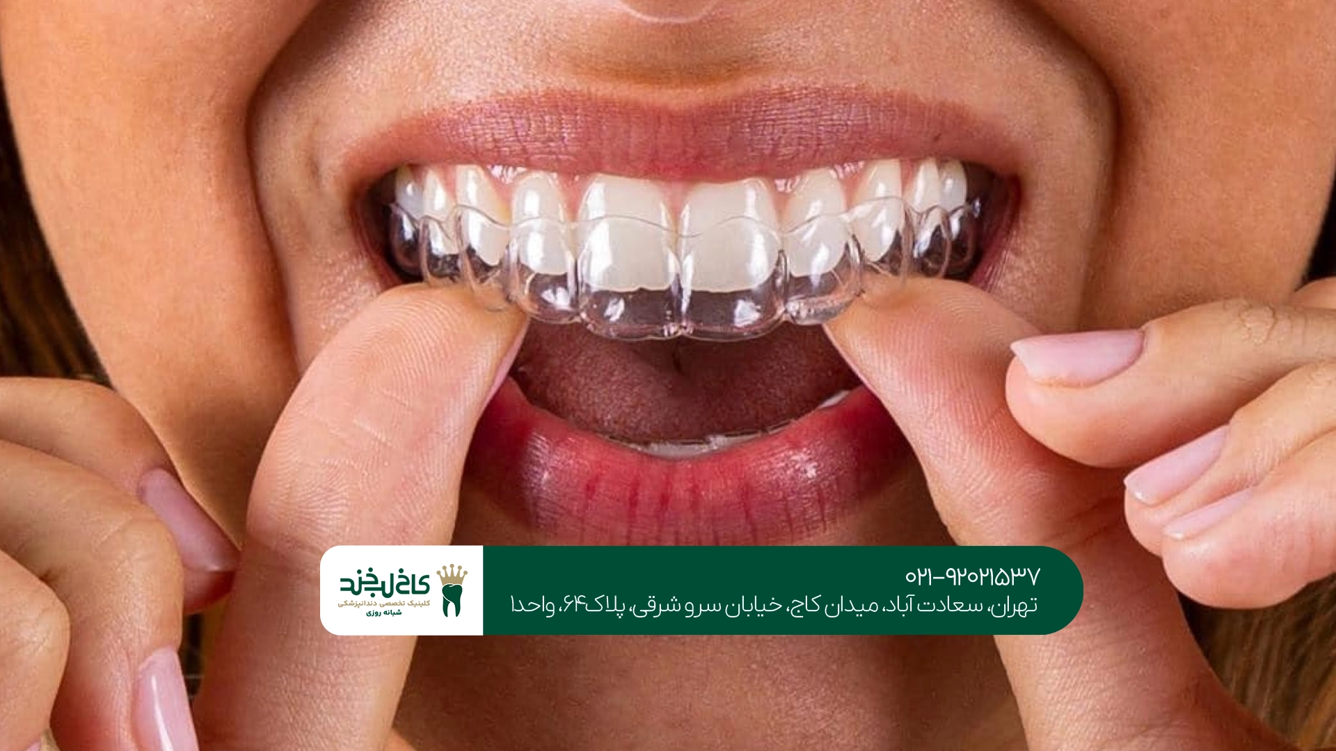 مرکز تخصصی اینویزیلاین تهران