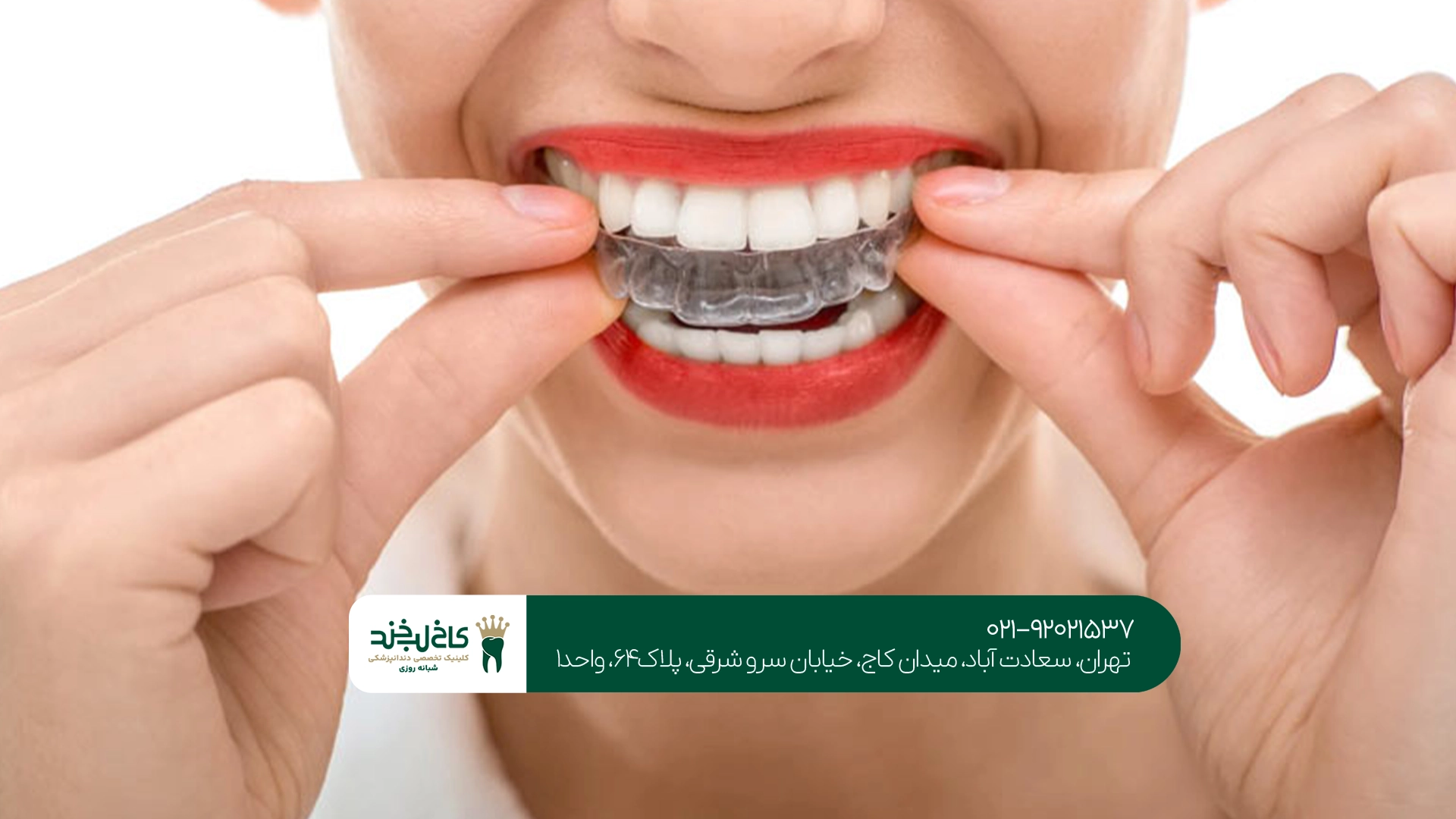 کلینیک حرفهای اینویزیلاین تهران
