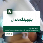 بلیچینگ دندان