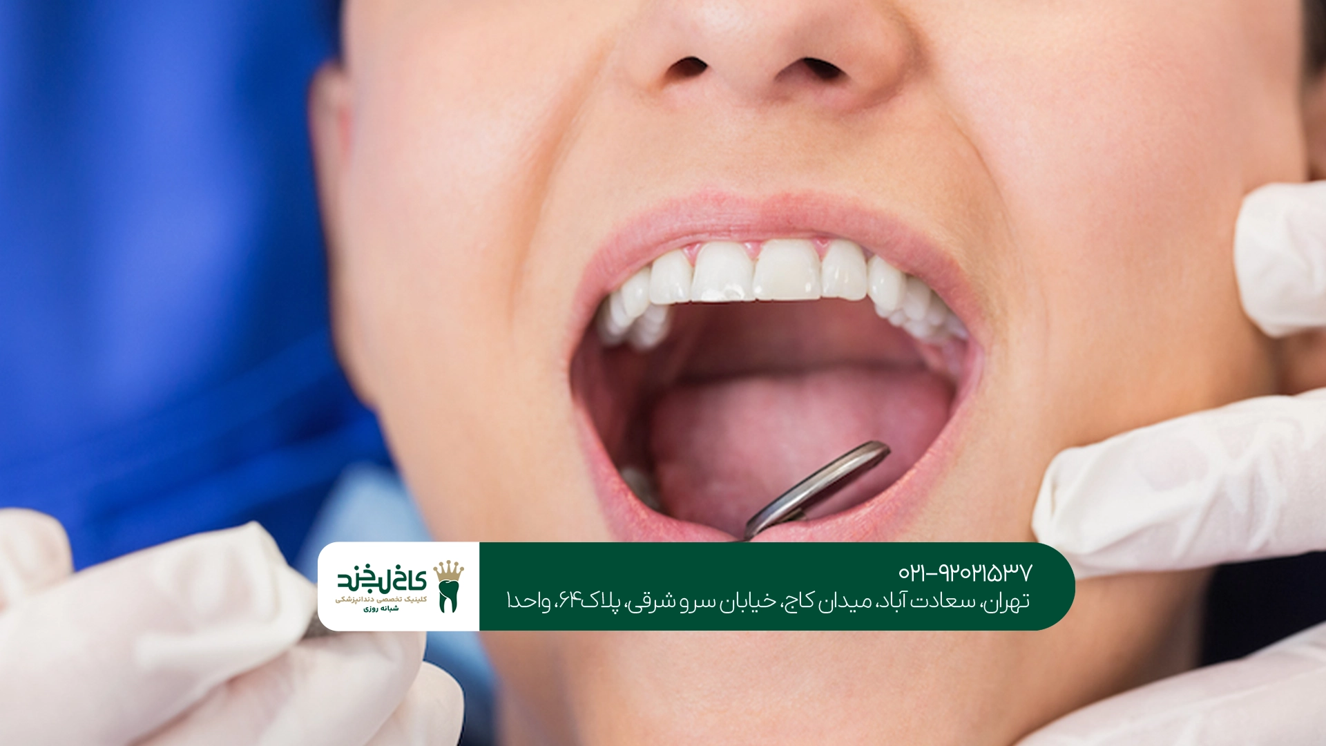خدمات دندانپزشک در سعادت آباد
