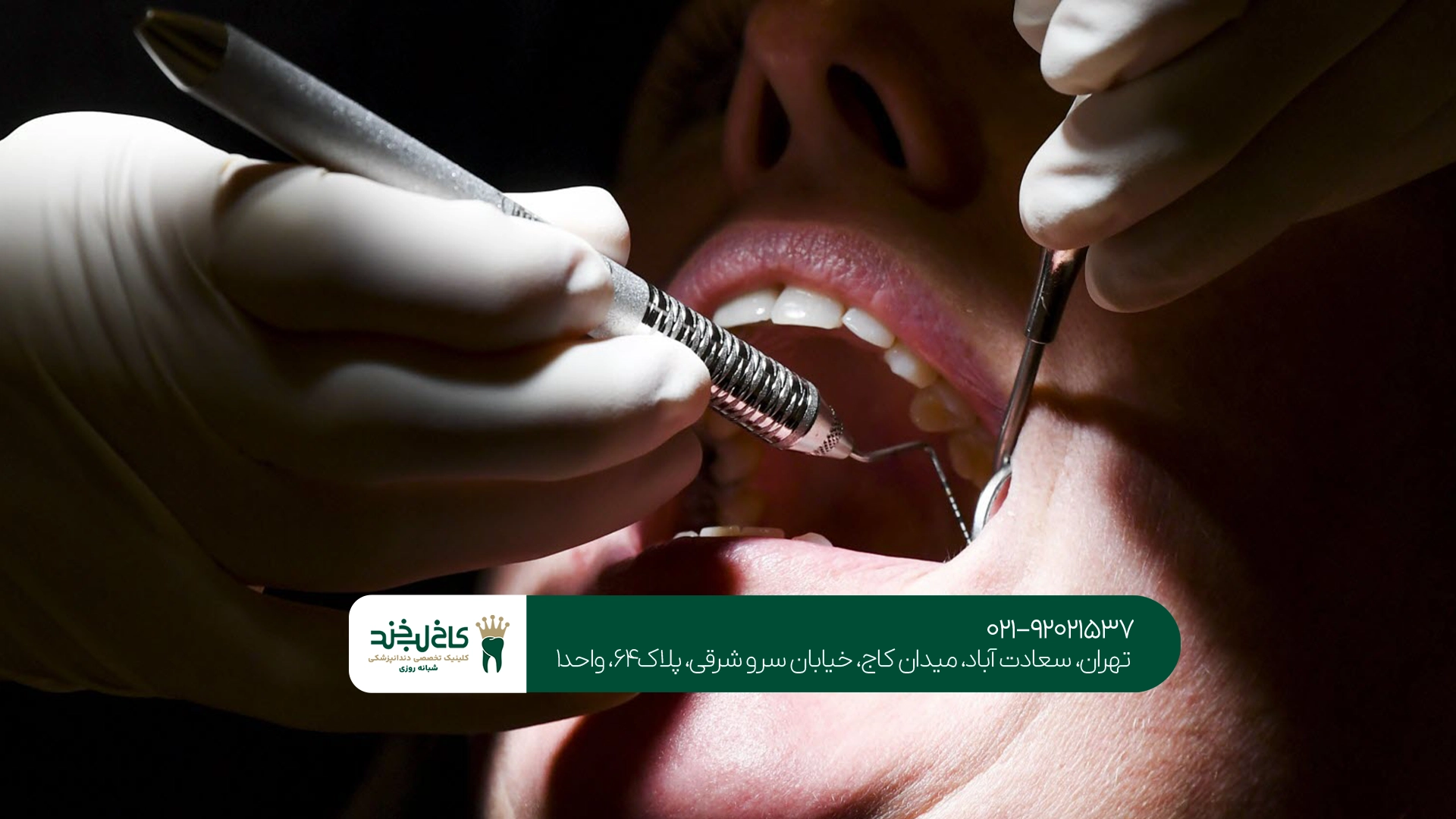بهترین دندانپزشکی بهترین دندانپزشکی