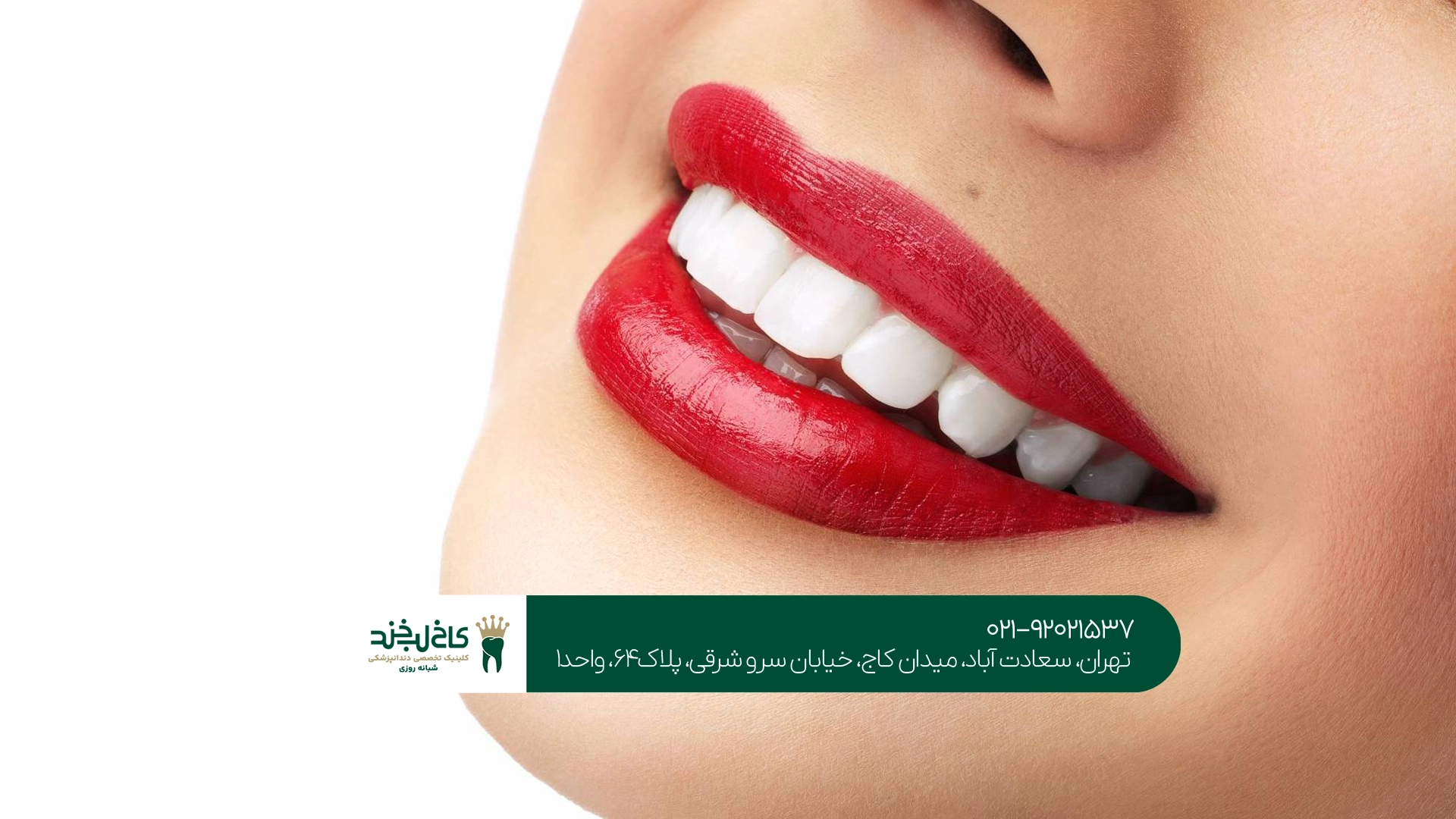 بهترین روش زیبایی دندان بدون تراش چیست؟