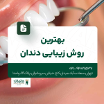 بهترین روش زیبایی دندان