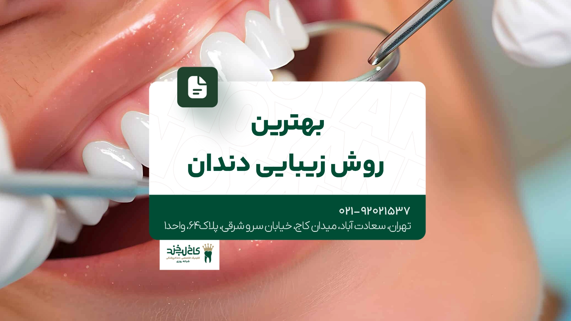 بهترین روش زیبایی دندان