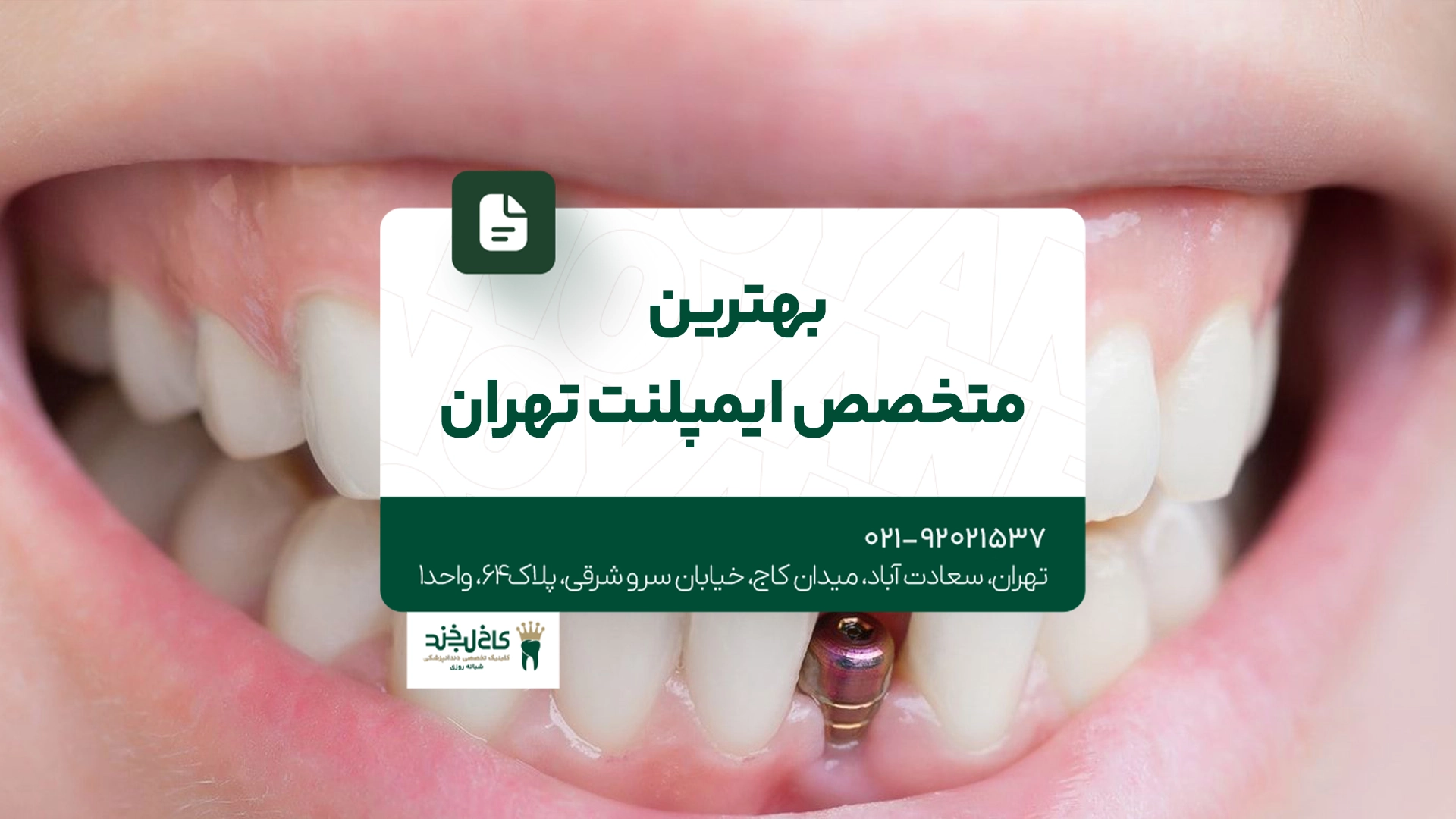 بهترین متخصص ایمپلنت تهران