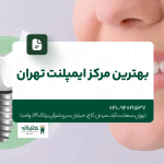 بهترین مرکز ایمپلنت تهران