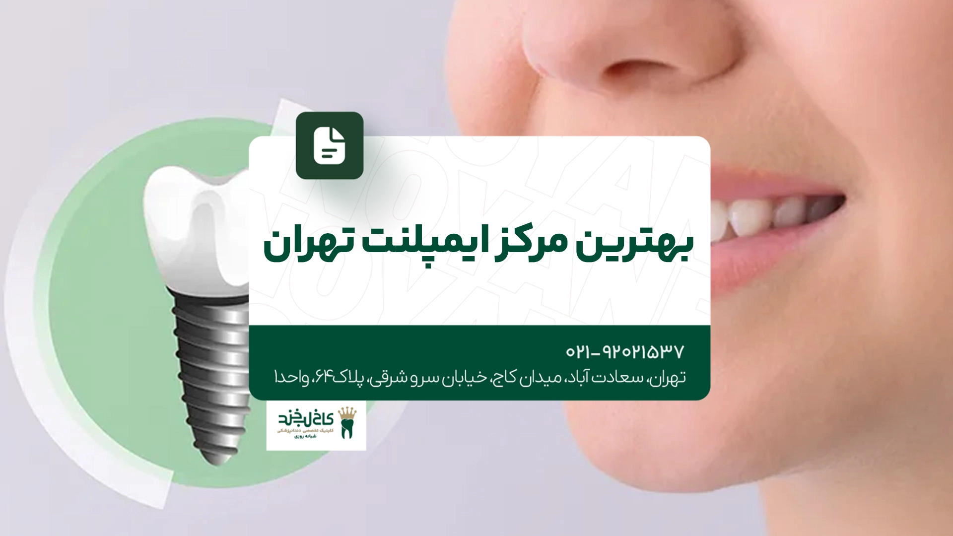 بهترین مرکز ایمپلنت تهران