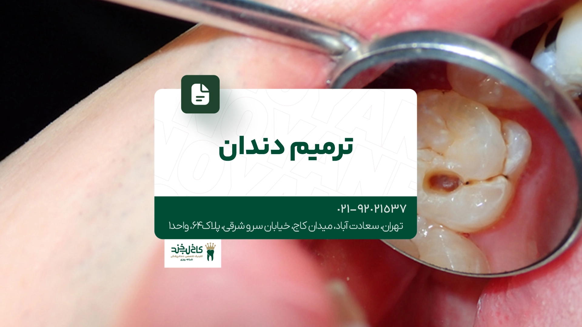 ترمیم دندان