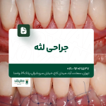 جراحی لثه