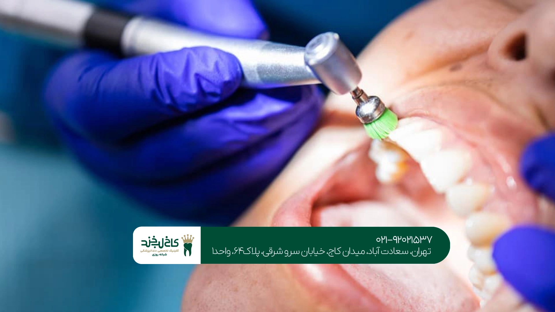 مرکز تخصصی جرم گیری دندان
