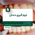 جرم گیری دندان