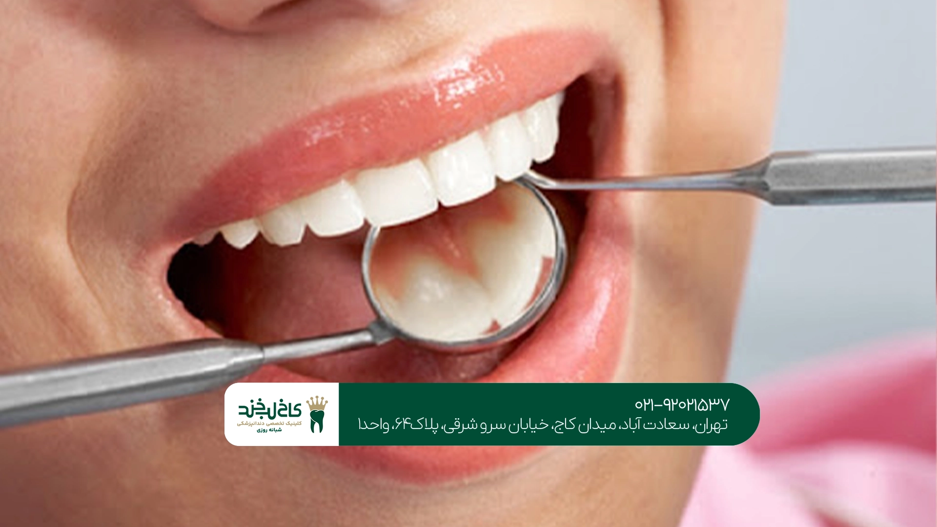 چگونه خدمات درمانی مناسب دندان را انتخاب کنیم؟