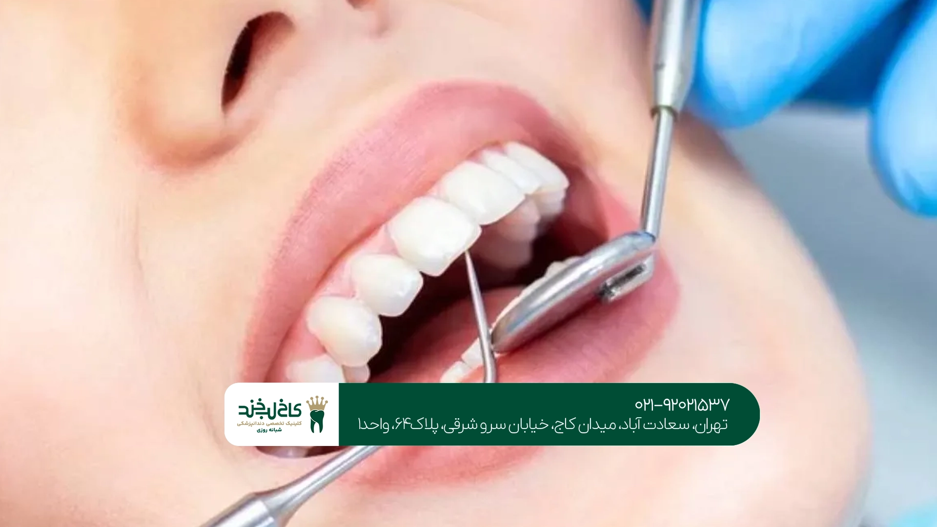 درمان بیماریهای لثه و مشکلات بافت اطراف دندان