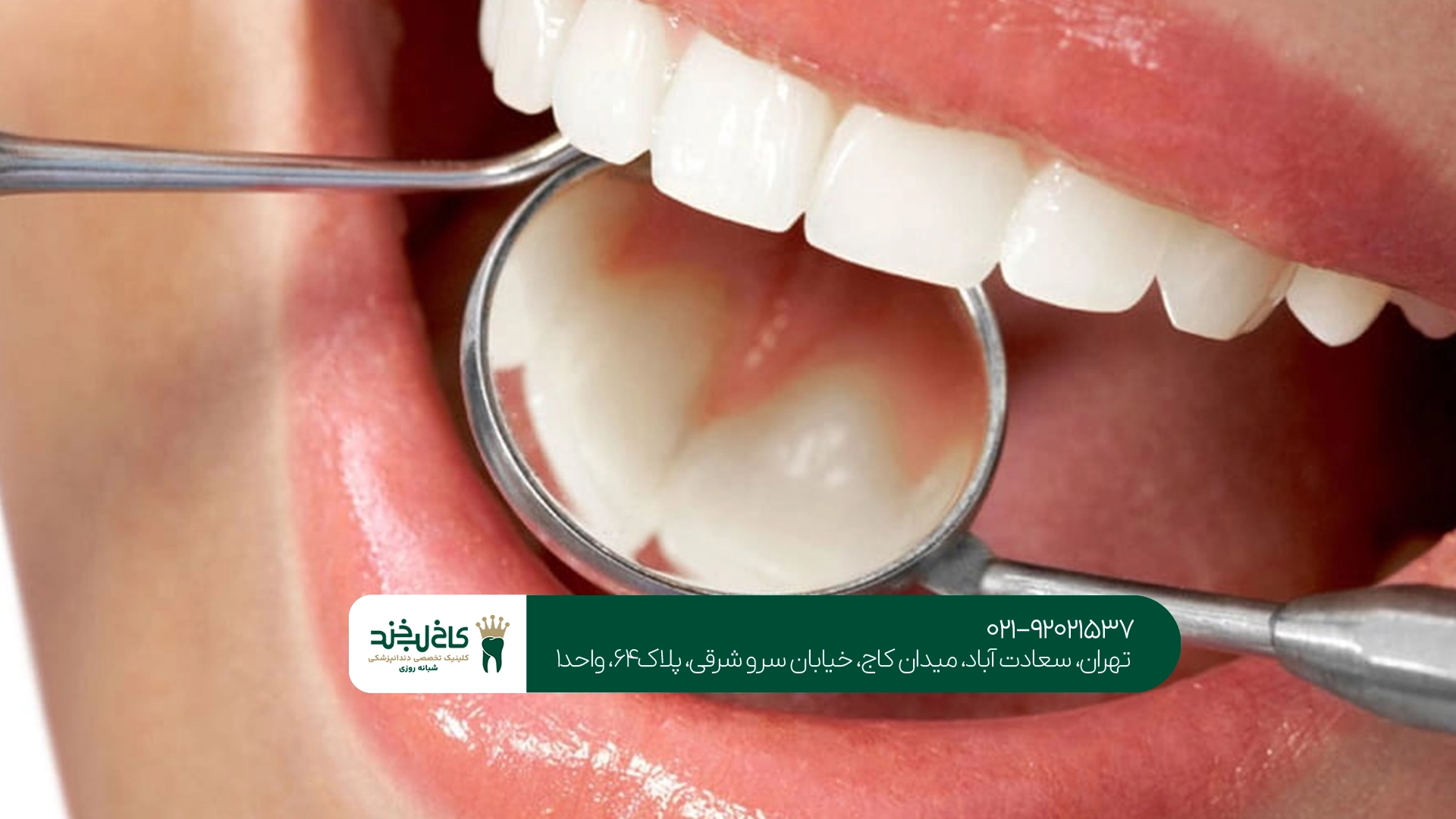 دندانپزشک ترمیمی برای دندان شکسته