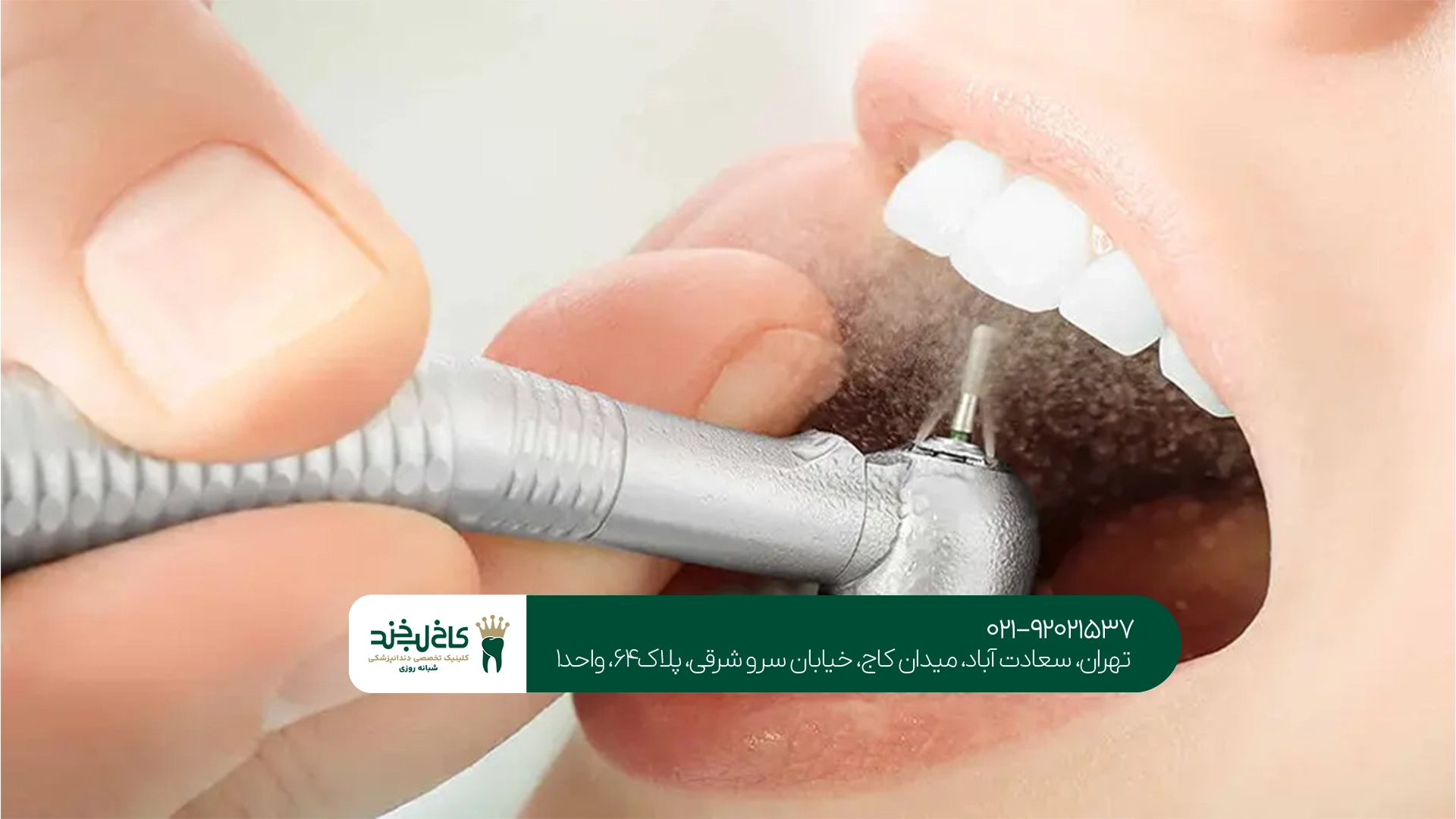 ترمیم دندان با دندانپزشک ترمیمی