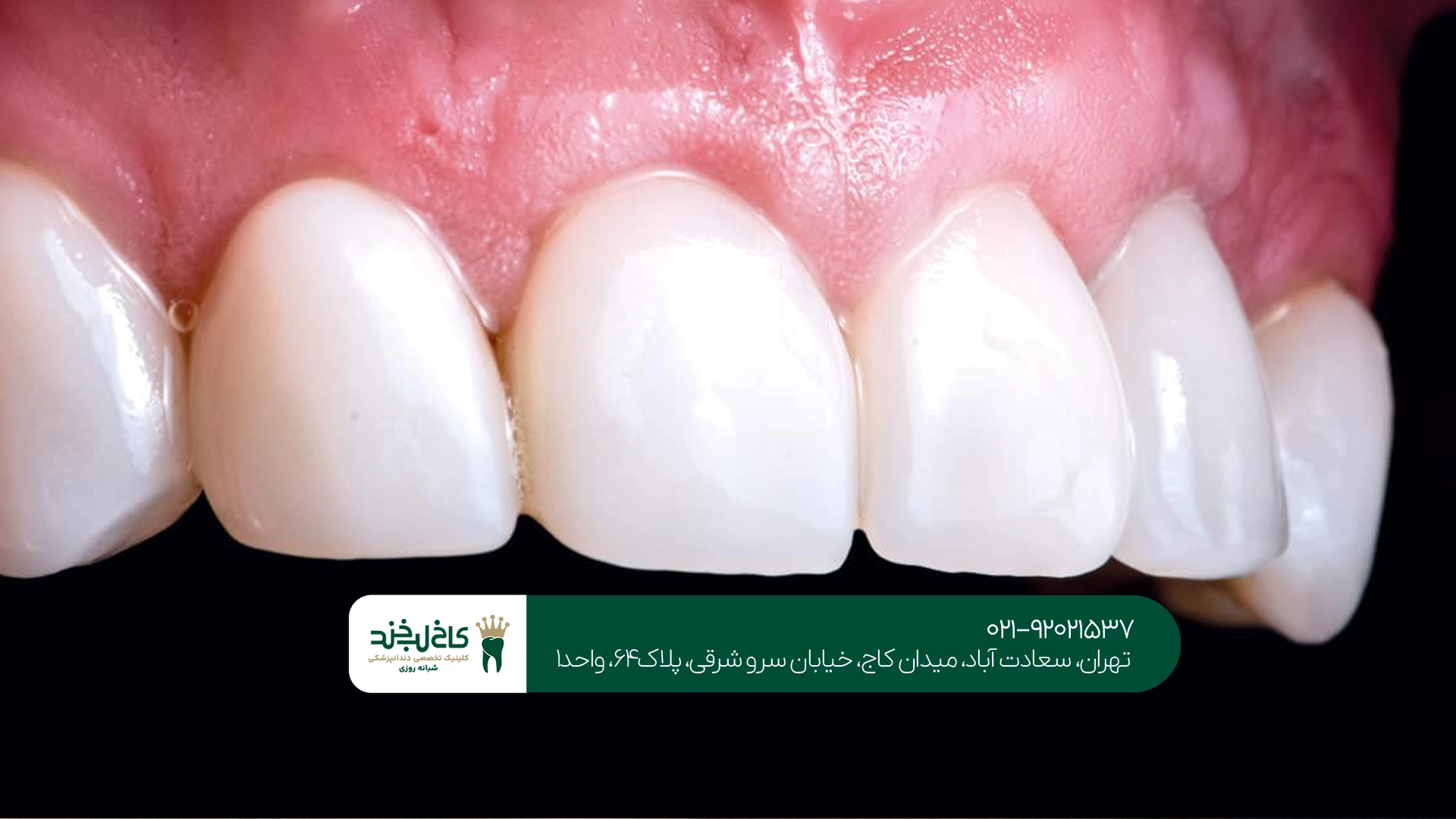 دندانپزشک کودکان در سعادت آباد چه خدماتی دارد؟
