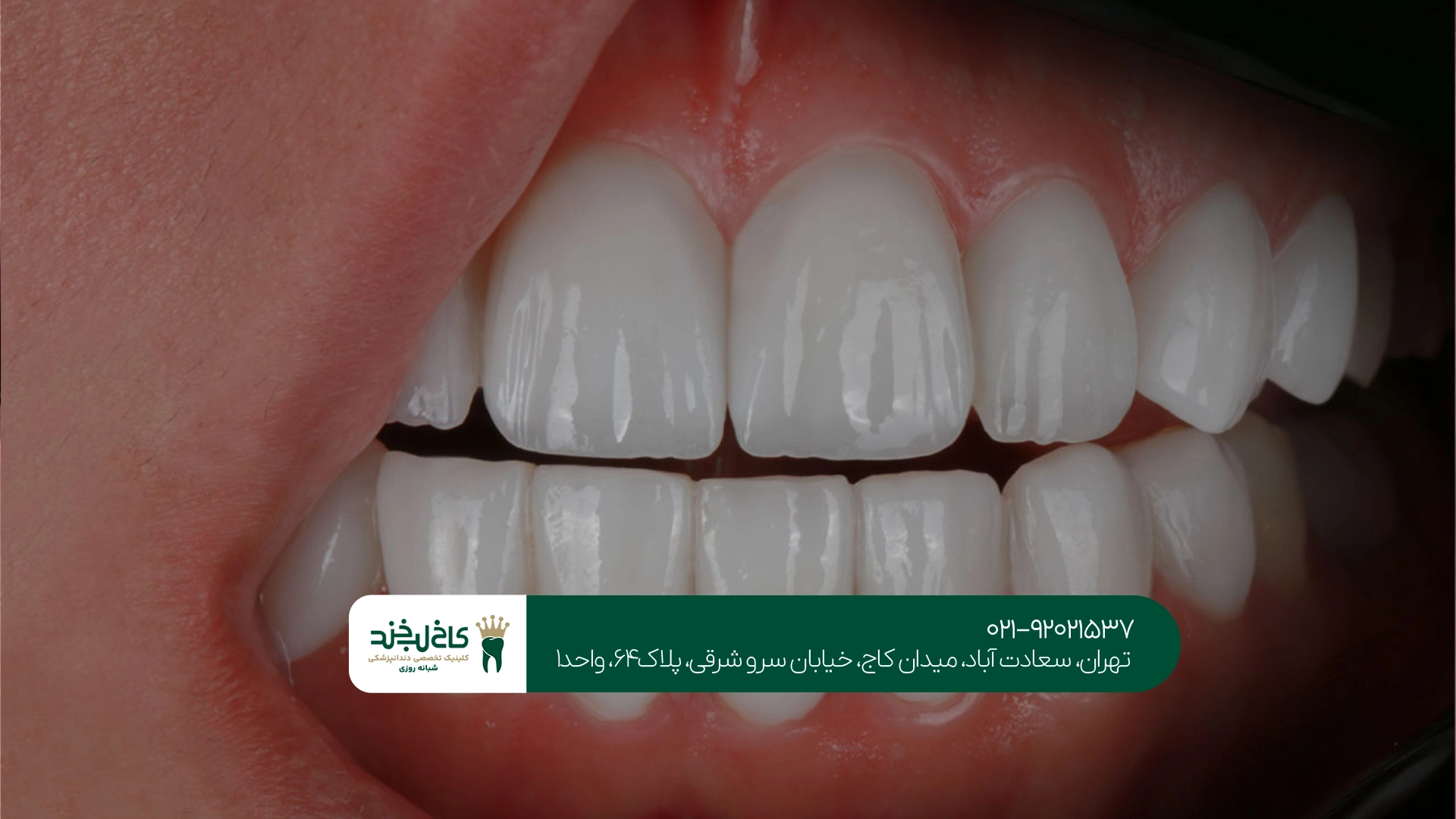 دندانپزشک عمومی در سعادت آباد