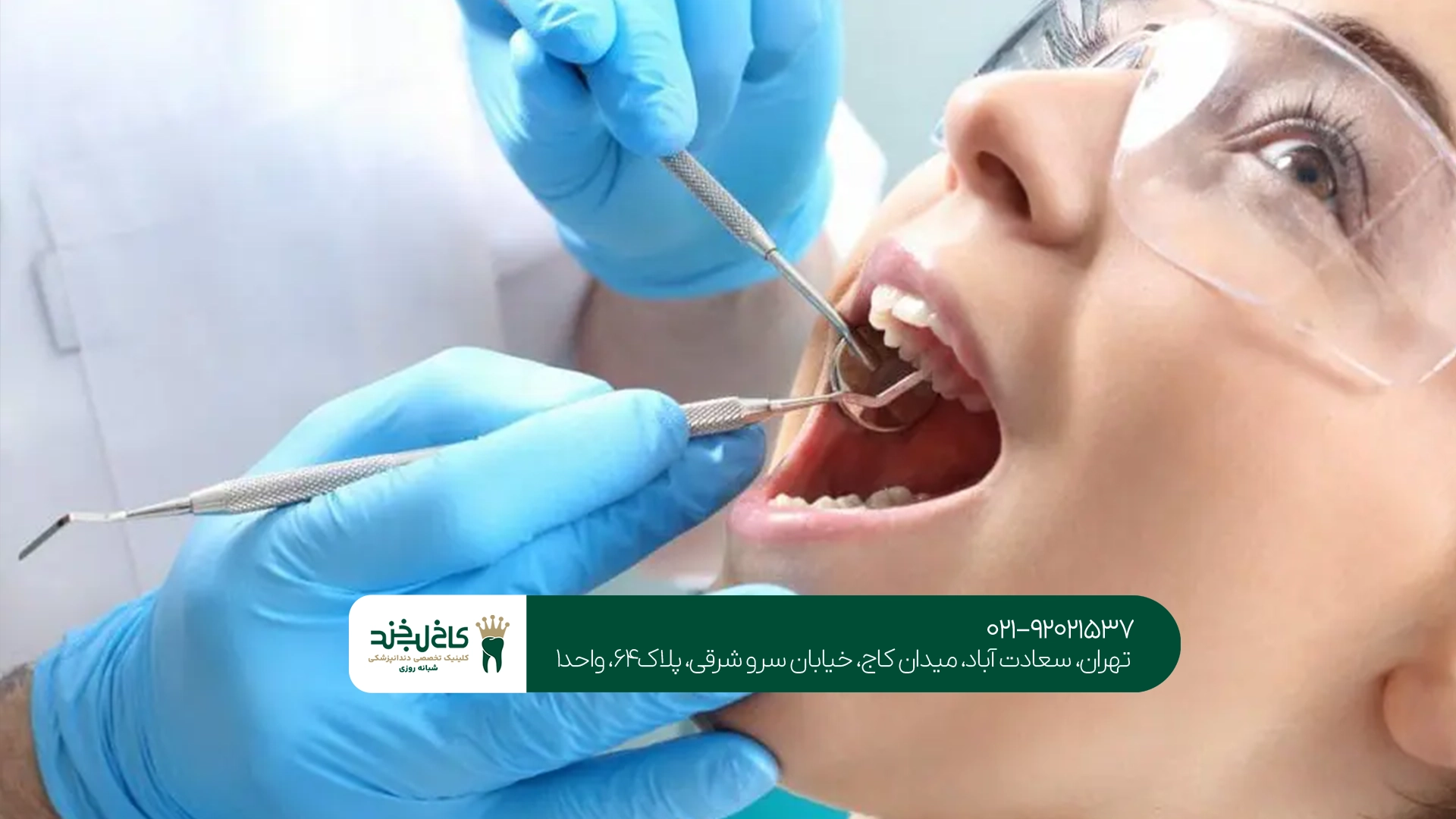 ترمیم دندانهای شیری چگونه انجام میشود؟ ترمیم دندانهای شیری چگونه انجام میشود؟