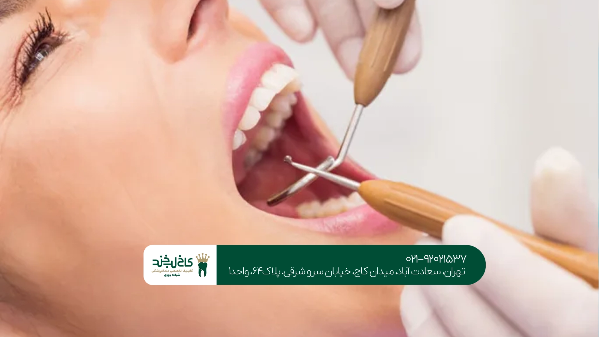 نزدیکترین مرکز دندانپزشکی برای عصبکشی و ترمیم
