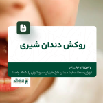 روکش دندان شیری