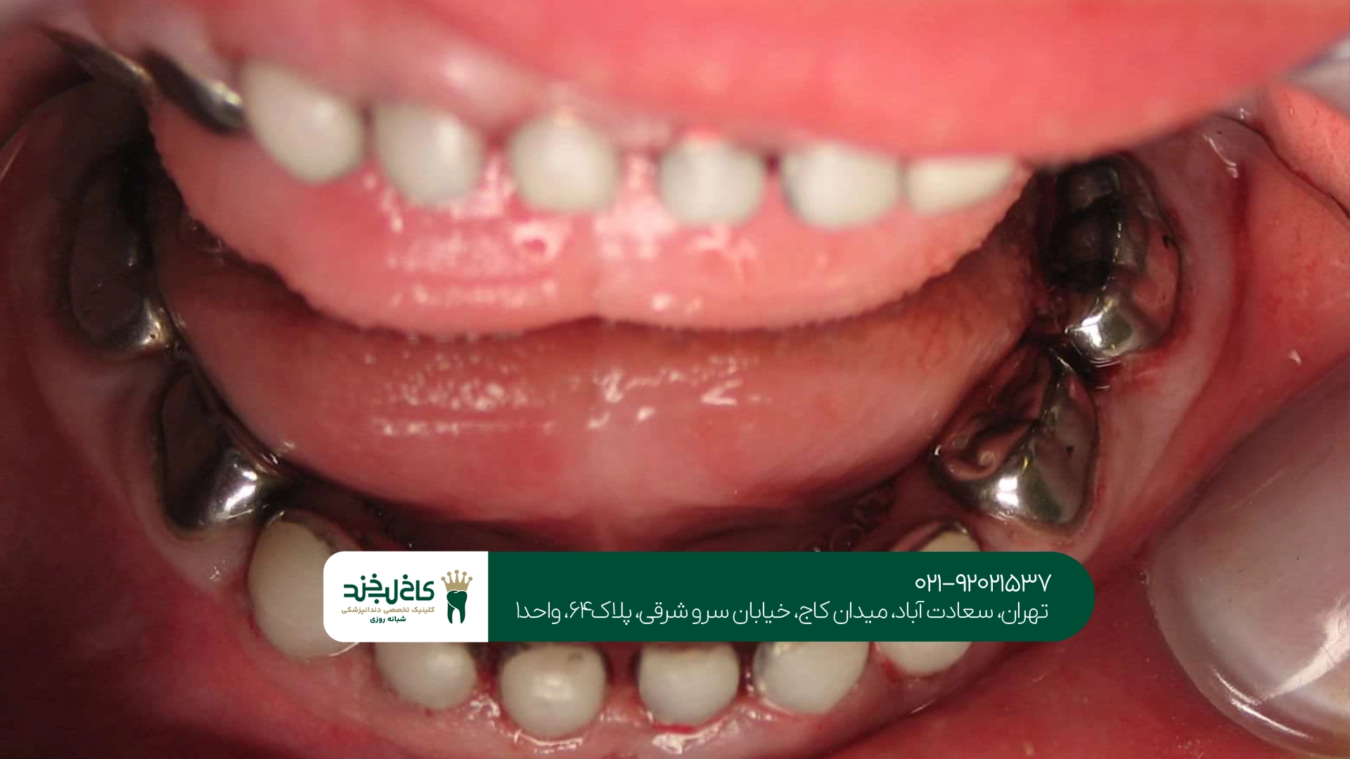 مرکز دندانپزشکی کودکان سعادت آباد