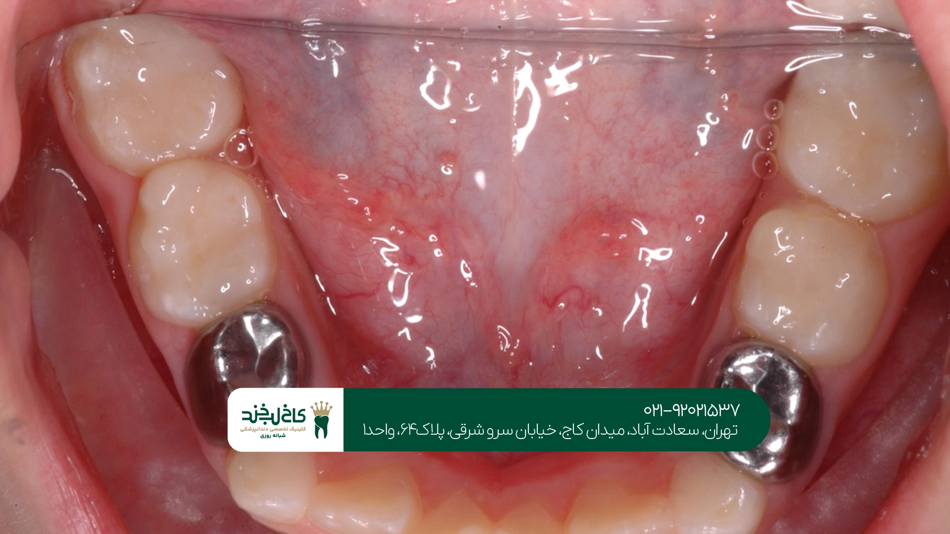 مرکز درمان دندان کودکان تهران