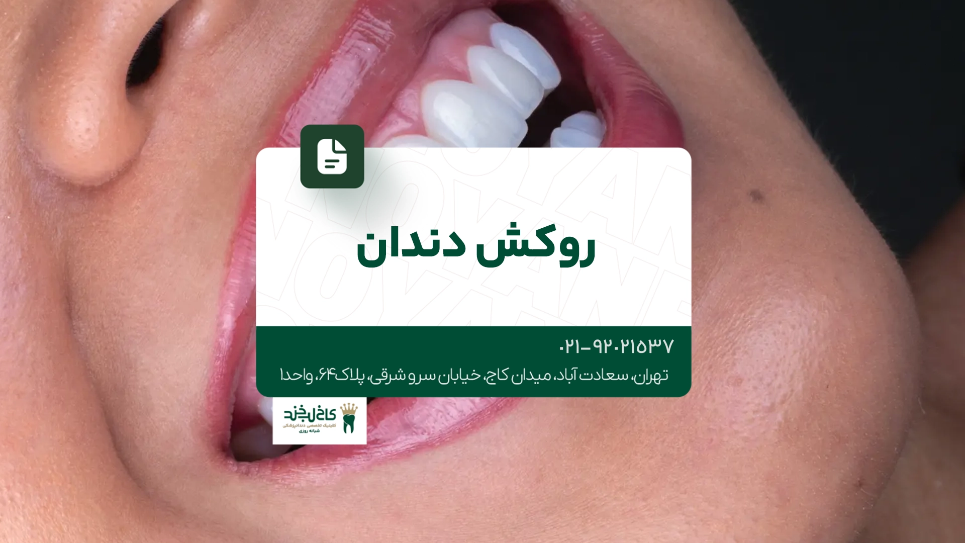 دندانپزشکی زیبایی