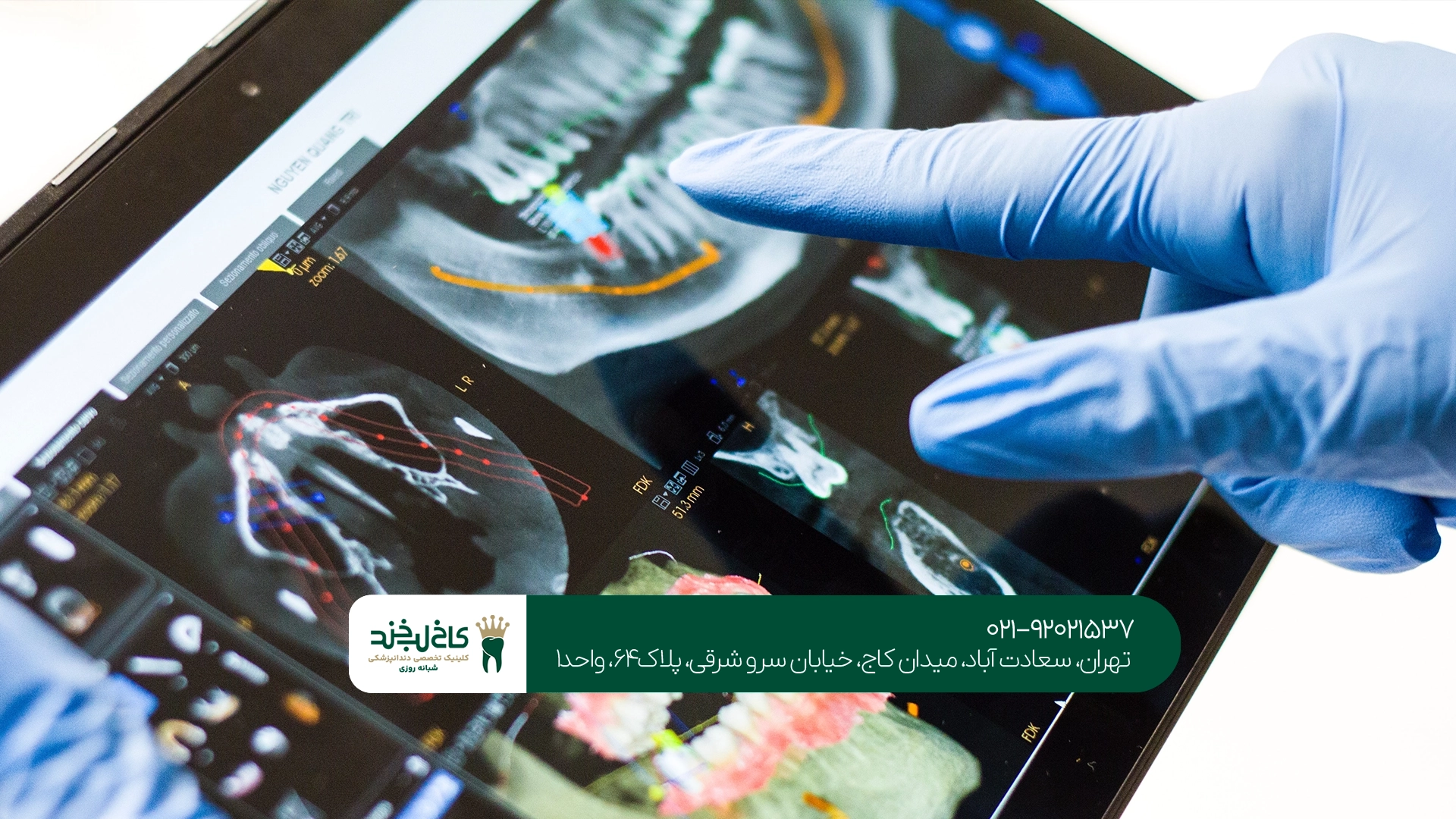 چگونه عکس OPG دندان رایگان دریافت کنیم؟
