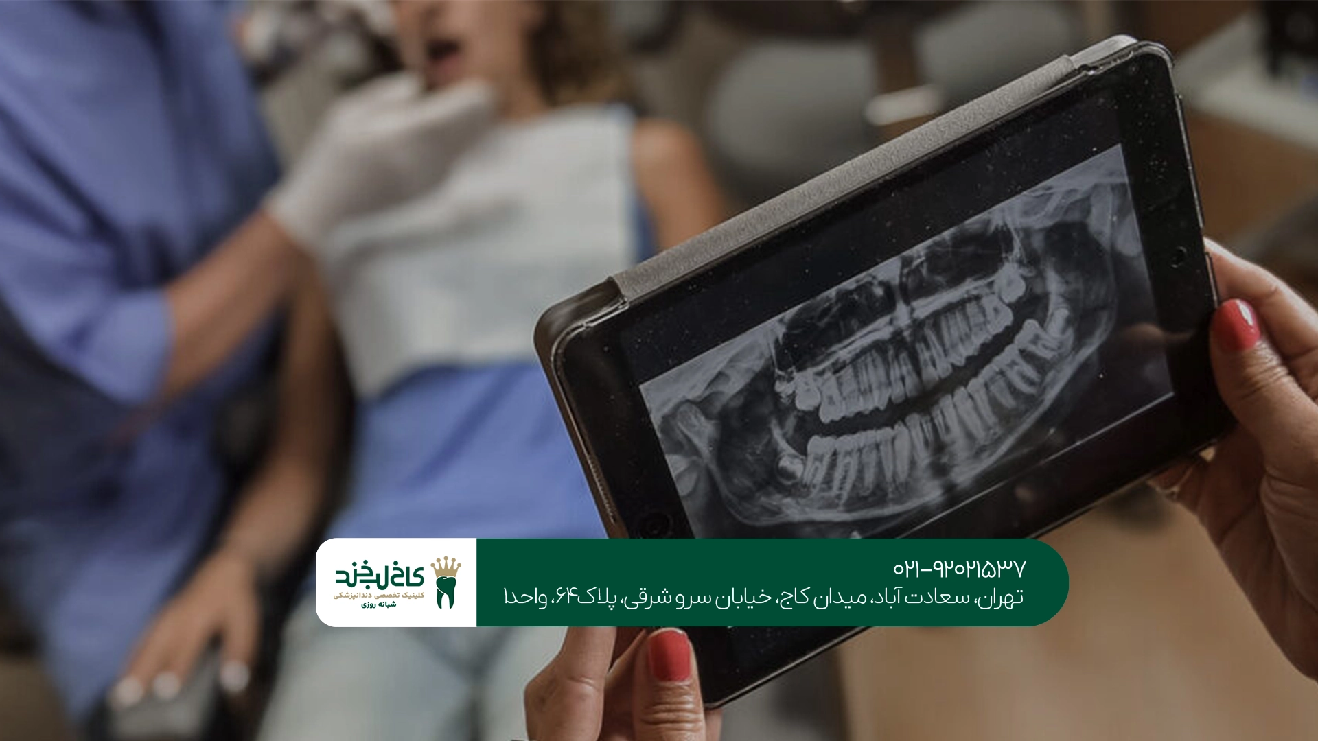 عکس OPG رایگان برای بررسی دندانهای نهفته
