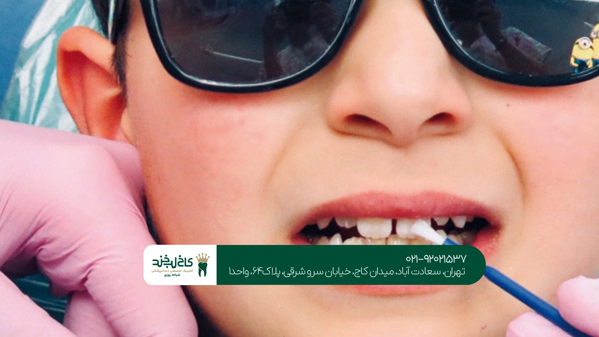 فواید فلورایدتراپی برای کودکان چیست؟
