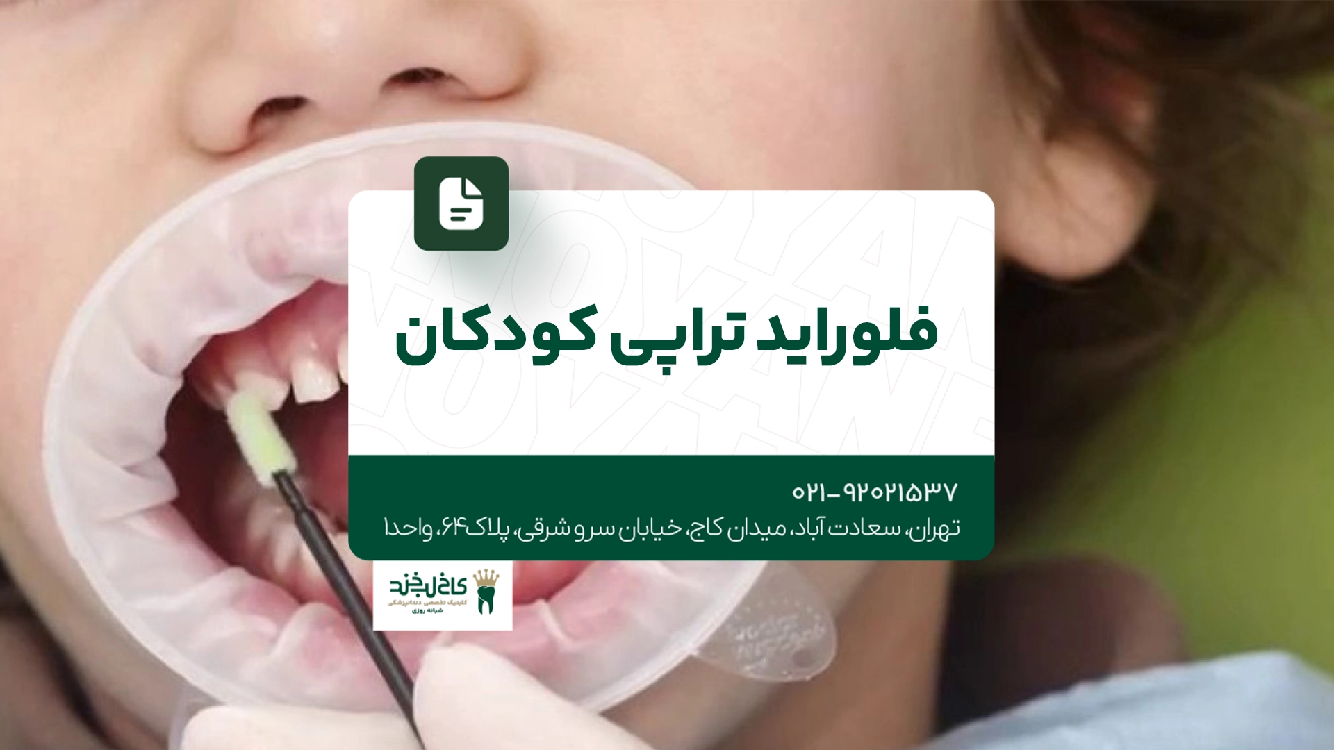 فلورایدتراپی کودکان