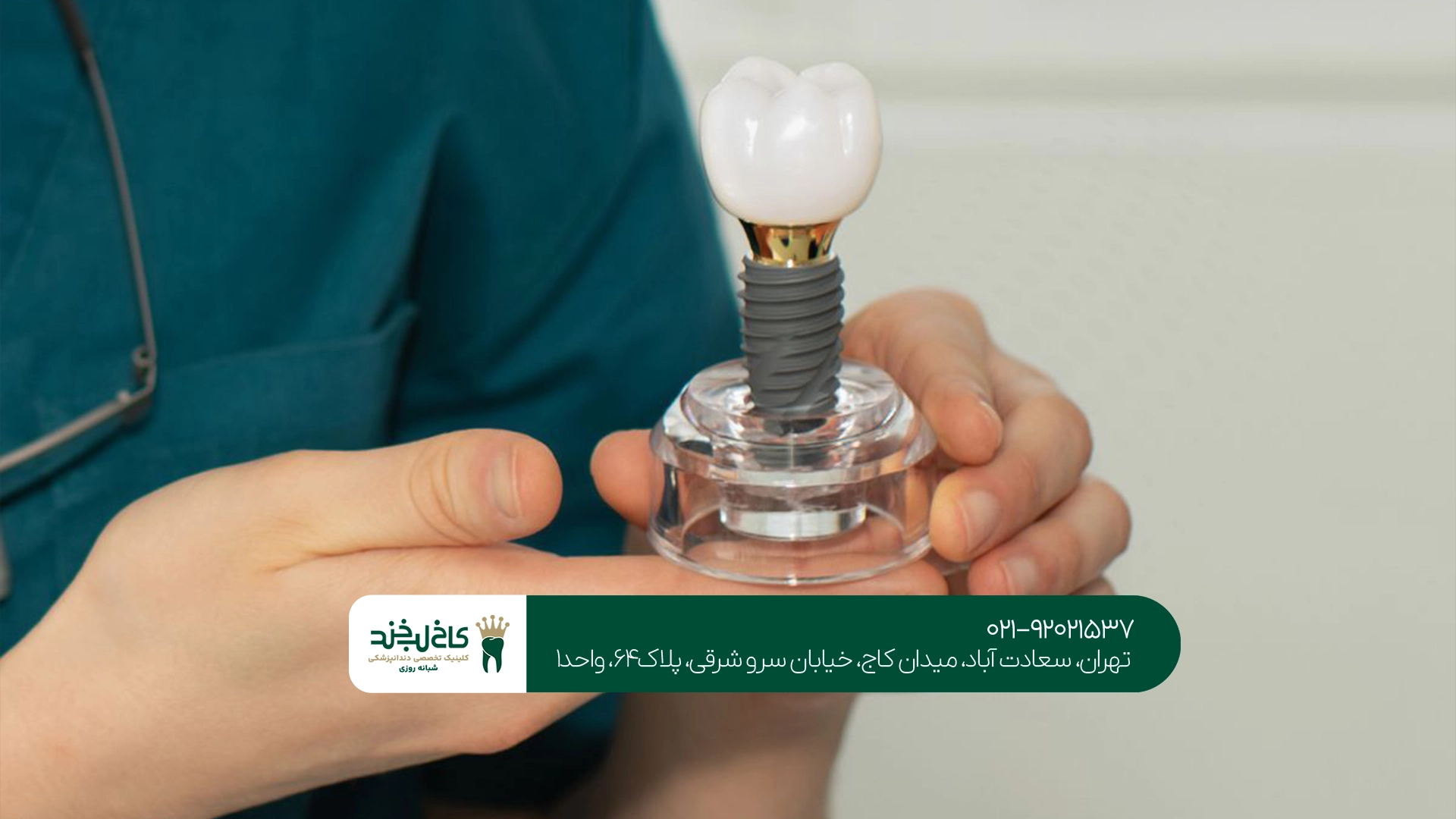 هزینه ایمپلنت کامل فک
