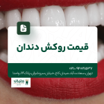 قیمت روکش دندان
