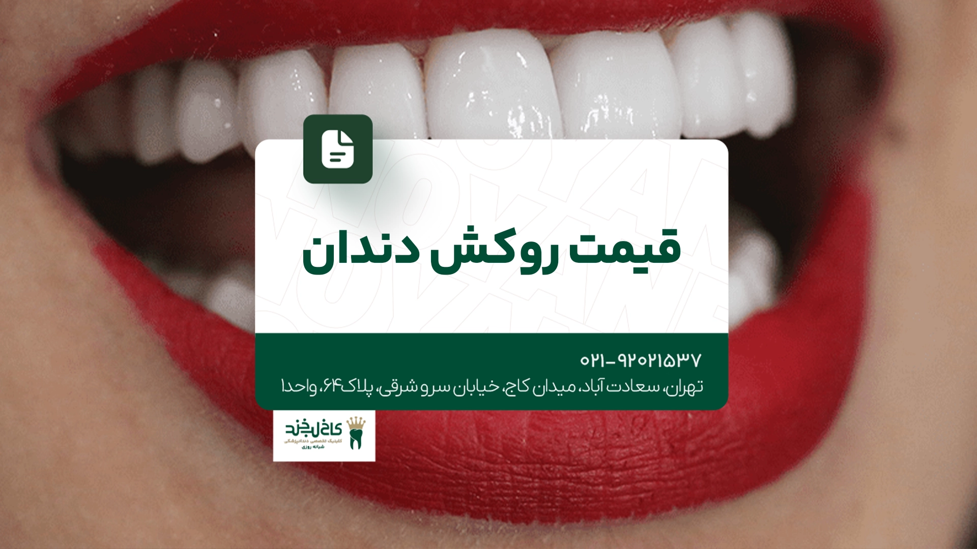 قیمت روکش دندان