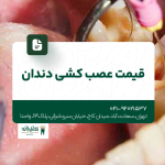 قیمت عصب کشی دندان