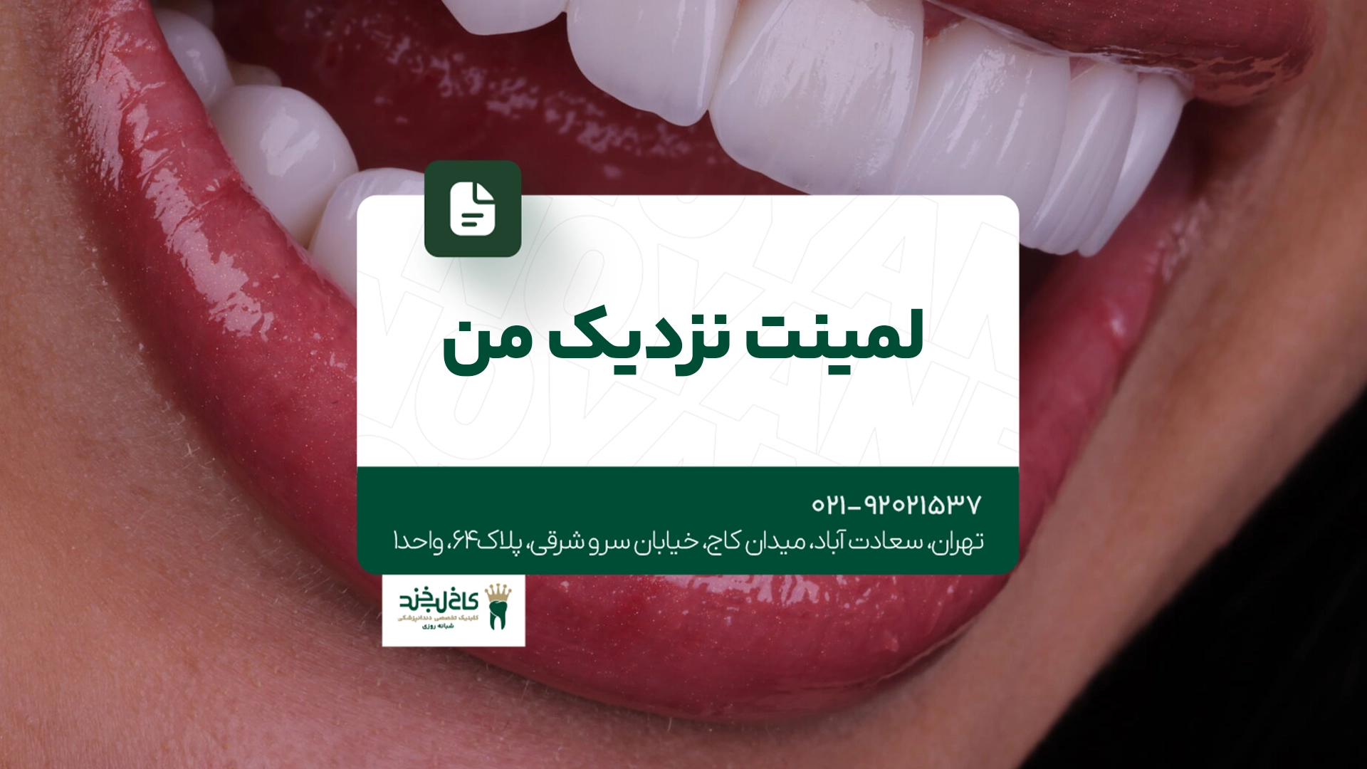 لمینت نزدیک من لمینت نزدیک من