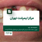 مرکز ایمپلنت تهران