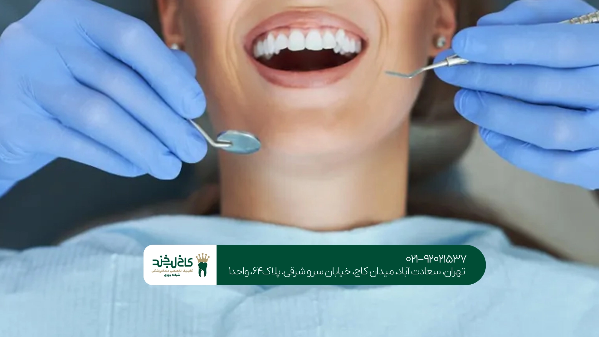 چگونه از مشاوره رایگان دندانپزشکی استفاده کنیم؟