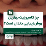 چرا کامپوزیت بهترین روش زیبایی دندان است؟